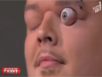 Zapping : Il sort son oeil de l’orbite