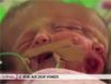 Zapping : un bébé à 2 visages dans le “magazine de la santé”…
