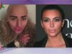 Zapping : Il veut ressembler à Kim Kardashian et c’est horrible…