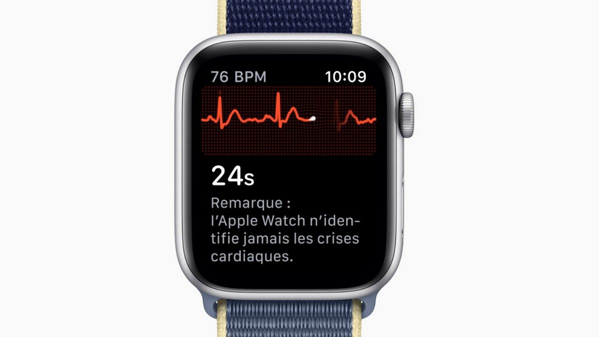 Suivi cardiaque avec l’Apple Watch : un médecin attaque la firme à la pomme